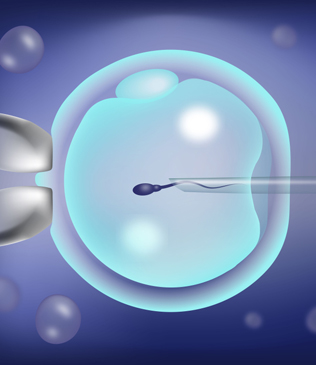 IVF / ICSI Treatment